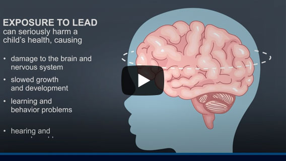 YouTube Link: Centers for Disease Control and Prevention (CDC) - Lead is a naturally occurring metal that can cause health problems in children younger than 6 years of age. At high levels, lead poisoning can be fatal. No safe blood lead level has been identified. This video provides a brief overview of why it is important to protect young children from lead exposure and the importance of blood lead testing.